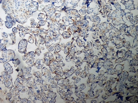 Immunohistochemistry (Formalin/PFA-fixed paraffin-embedded sections) - Anti-Inhibin alpha antibody [R1] (ab14087), expandable thumbnail