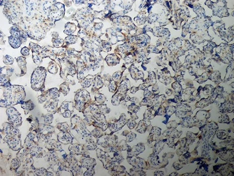 Immunohistochemistry (Formalin/PFA-fixed paraffin-embedded sections) - Anti-Inhibin alpha antibody [R1] (AB14087)