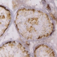 Immunohistochemistry (Formalin/PFA-fixed paraffin-embedded sections) - Anti-Inhibin alpha antibody [R1] (AB14087), expandable thumbnail