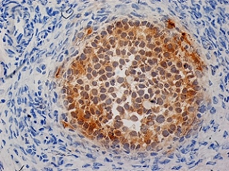 Immunohistochemistry (Formalin/PFA-fixed paraffin-embedded sections) - Anti-Inhibin alpha antibody [R1] (AB14087), expandable thumbnail