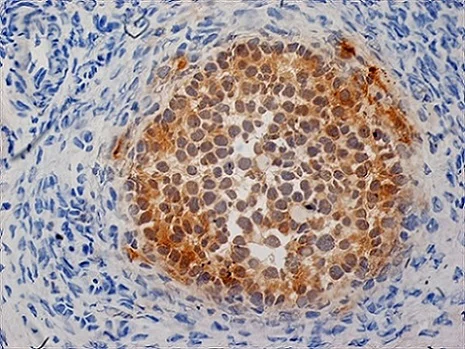 Immunohistochemistry (Formalin/PFA-fixed paraffin-embedded sections) - Anti-Inhibin alpha antibody [R1] (AB14087)