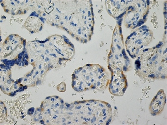 Immunohistochemistry (Formalin/PFA-fixed paraffin-embedded sections) - Anti-Inhibin alpha antibody [R1] (AB14087), expandable thumbnail