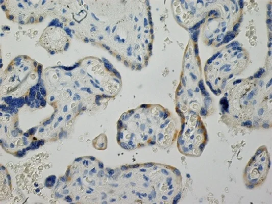 Immunohistochemistry (Formalin/PFA-fixed paraffin-embedded sections) - Anti-Inhibin alpha antibody [R1] (AB14087)