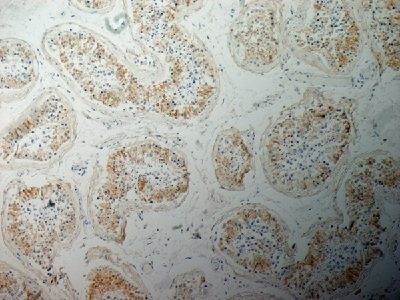 Immunohistochemistry (Formalin/PFA-fixed paraffin-embedded sections) - Anti-Inhibin alpha antibody [R1] (AB14087), expandable thumbnail