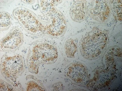 Immunohistochemistry (Formalin/PFA-fixed paraffin-embedded sections) - Anti-Inhibin alpha antibody [R1] (AB14087)