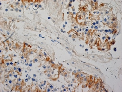 Immunohistochemistry (Formalin/PFA-fixed paraffin-embedded sections) - Anti-Inhibin alpha antibody [R1] (AB14087), expandable thumbnail