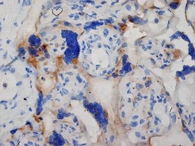 Immunohistochemistry (Formalin/PFA-fixed paraffin-embedded sections) - Anti-Inhibin alpha antibody [R1] (ab14087), expandable thumbnail
