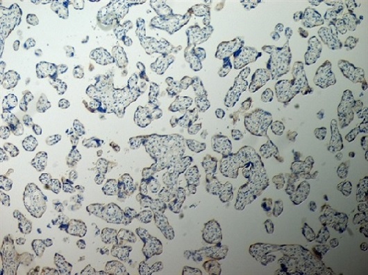 Immunohistochemistry (Formalin/PFA-fixed paraffin-embedded sections) - Anti-Inhibin alpha antibody [R1] (ab14087), expandable thumbnail