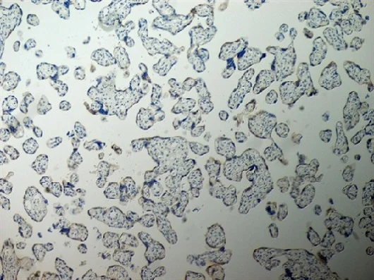 Immunohistochemistry (Formalin/PFA-fixed paraffin-embedded sections) - Anti-Inhibin alpha antibody [R1] (AB14087)