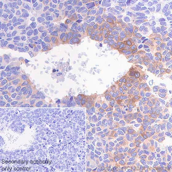 Immunohistochemistry (Formalin/PFA-fixed paraffin-embedded sections) - Anti-Inhibin alpha antibody [SP323] - BSA and Azide free (AB242422)