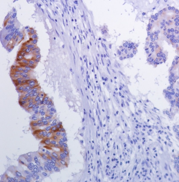 Immunohistochemistry (Formalin/PFA-fixed paraffin-embedded sections) - Anti-Inhibin alpha antibody [SP323] - BSA and Azide free (AB242422), expandable thumbnail