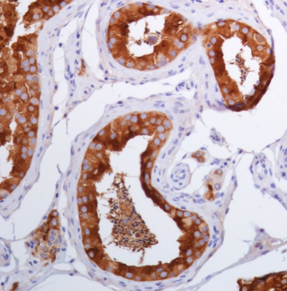 Immunohistochemistry (Formalin/PFA-fixed paraffin-embedded sections) - Anti-Inhibin alpha antibody [SP323] - BSA and Azide free (AB242422), expandable thumbnail