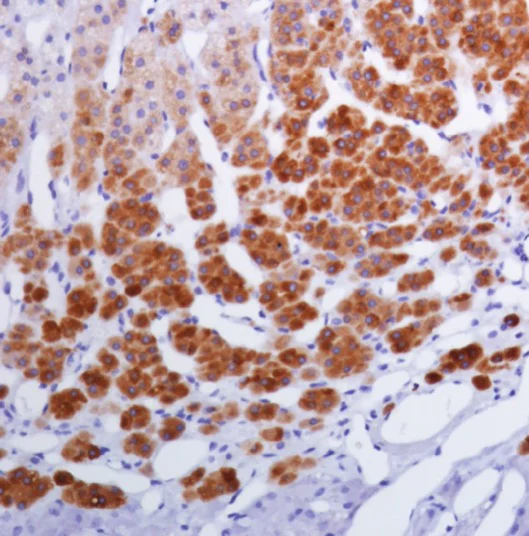 Immunohistochemistry (Formalin/PFA-fixed paraffin-embedded sections) - Anti-Inhibin alpha antibody [SP323] - BSA and Azide free (AB242422)