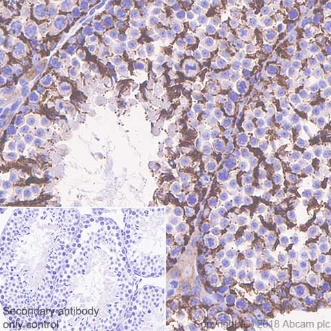 Immunohistochemistry (Formalin/PFA-fixed paraffin-embedded sections) - Anti-Inhibin alpha antibody [SP323] - BSA and Azide free (AB242422), expandable thumbnail
