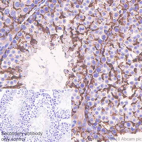 Immunohistochemistry (Formalin/PFA-fixed paraffin-embedded sections) - Anti-Inhibin alpha antibody [SP323] - BSA and Azide free (AB242422)