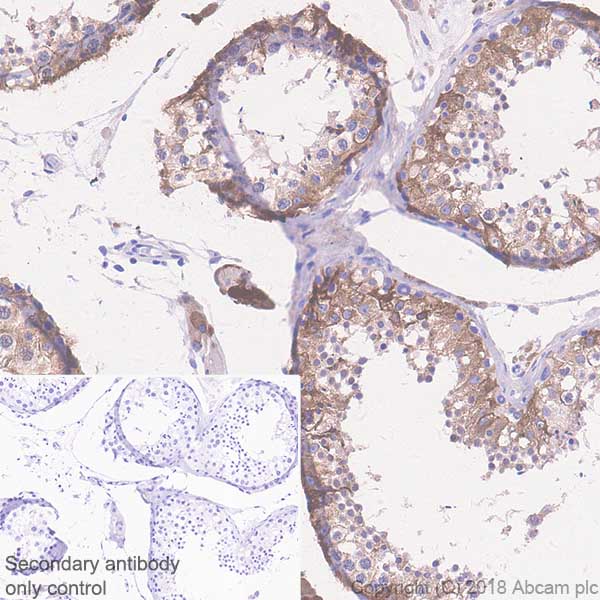Immunohistochemistry (Formalin/PFA-fixed paraffin-embedded sections) - Anti-Inhibin alpha antibody [SP323] - BSA and Azide free (AB242422), expandable thumbnail