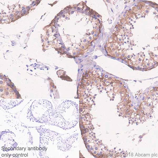 Immunohistochemistry (Formalin/PFA-fixed paraffin-embedded sections) - Anti-Inhibin alpha antibody [SP323] - BSA and Azide free (AB242422)
