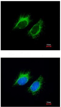Immunocytochemistry/ Immunofluorescence - Anti-Inhibin beta A antibody (AB97705), expandable thumbnail