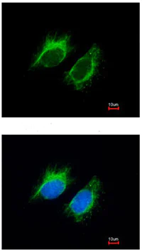 Immunocytochemistry/ Immunofluorescence - Anti-Inhibin beta A antibody (AB97705)