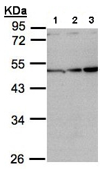 Western blot - Anti-Inhibin beta A antibody (AB97705), expandable thumbnail
