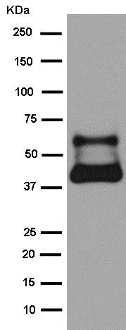 Western blot - Anti-Inhibin beta B antibody [EPR2787(2)] - BSA and Azide free (AB245139)