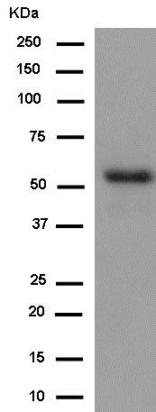 Western blot - Anti-Inhibin beta B antibody [EPR2787(2)] - BSA and Azide free (AB245139)