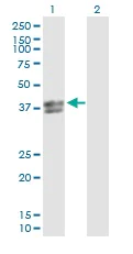 Western blot - Anti-Inhibin beta E chain antibody (AB103167)
