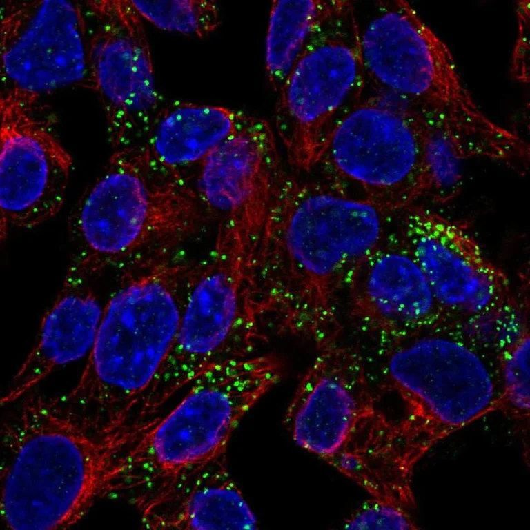 Immunocytochemistry/ Immunofluorescence - Anti-Inhibin beta E chain antibody (AB254687)