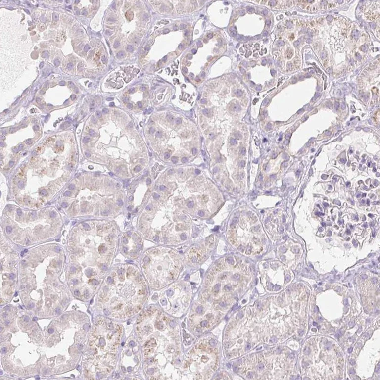 Immunohistochemistry (Formalin/PFA-fixed paraffin-embedded sections) - Anti-Inhibin beta E chain antibody (AB254687)