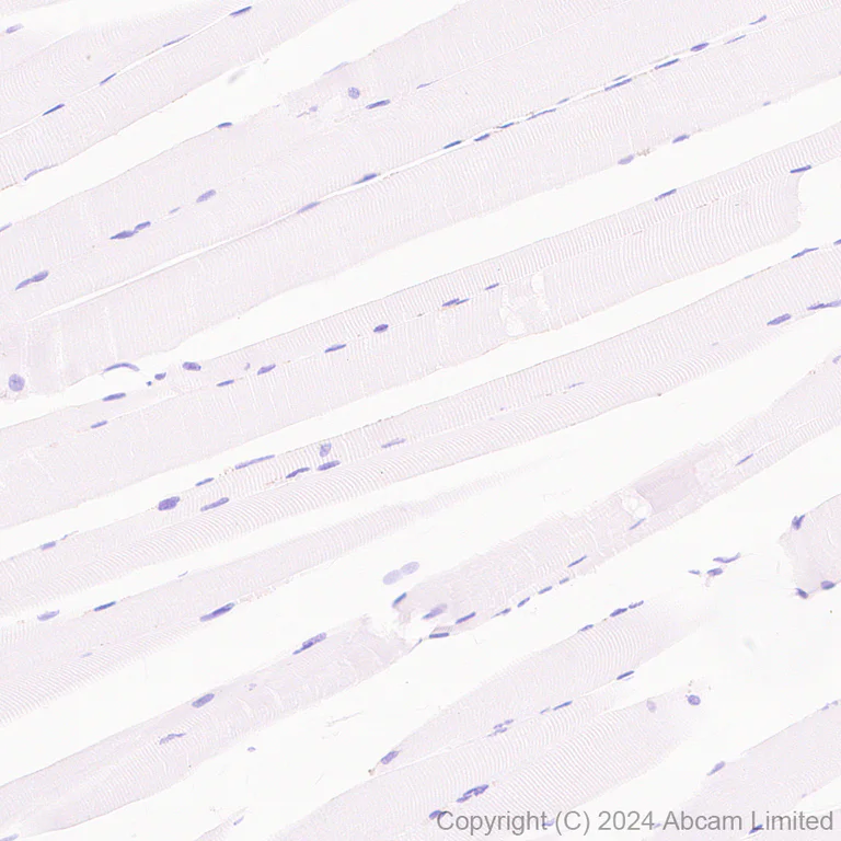 Immunohistochemistry (Formalin/PFA-fixed paraffin-embedded sections) - Anti-Inhibin beta E chain antibody [EPR29191-125] (AB322202)