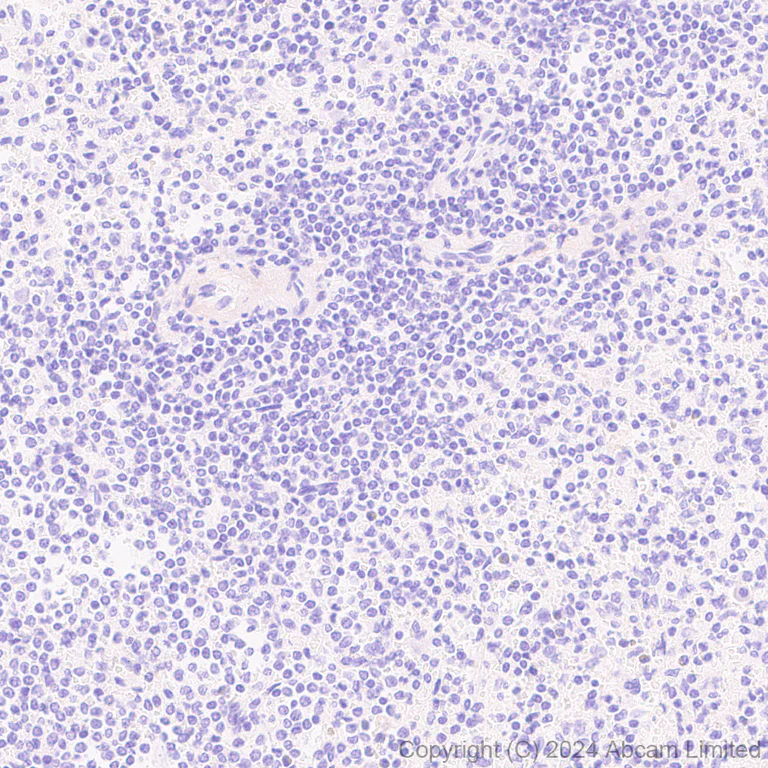 Immunohistochemistry (Formalin/PFA-fixed paraffin-embedded sections) - Anti-Inhibin beta E chain antibody [EPR29191-125] (AB322202)
