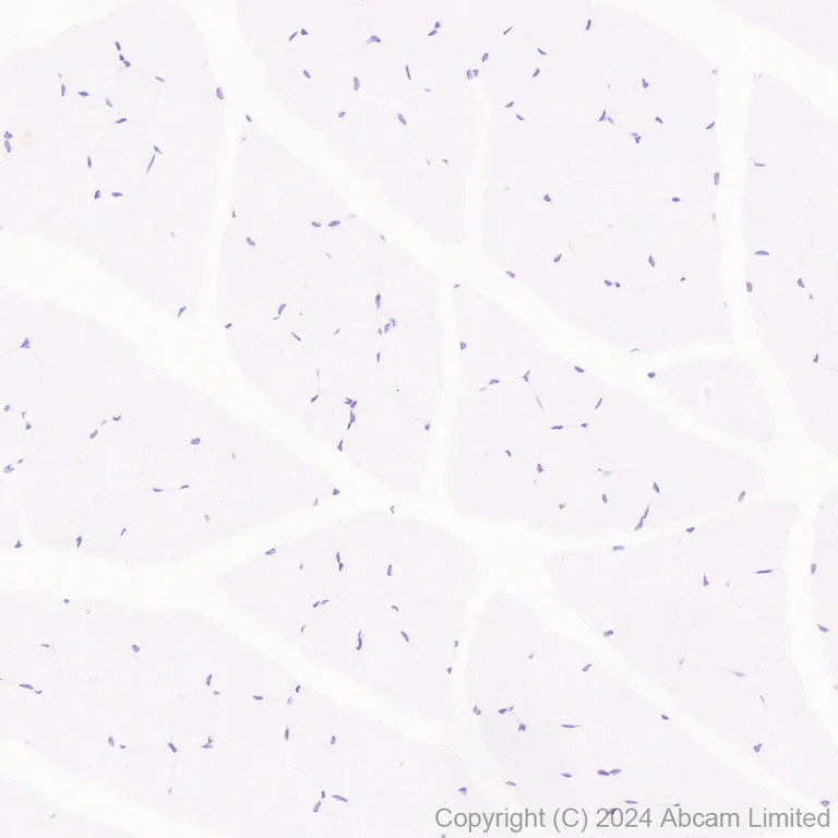 Immunohistochemistry (Formalin/PFA-fixed paraffin-embedded sections) - Anti-Inhibin beta E chain antibody [EPR29191-125] (AB322202)