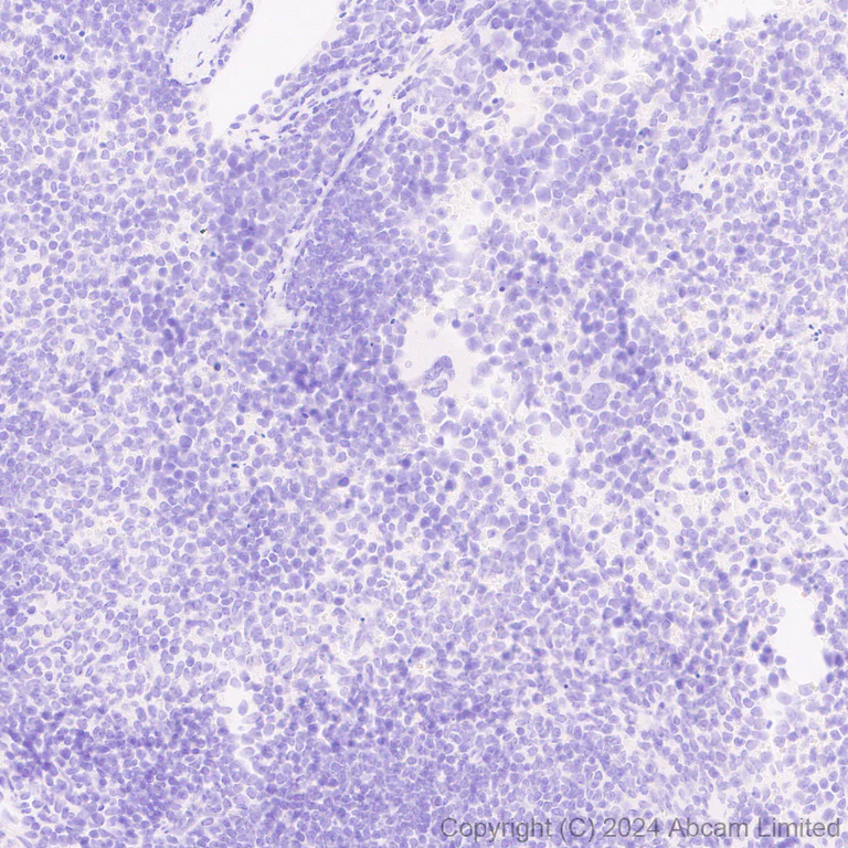 Immunohistochemistry (Formalin/PFA-fixed paraffin-embedded sections) - Anti-Inhibin beta E chain antibody [EPR29191-125] (AB322202)