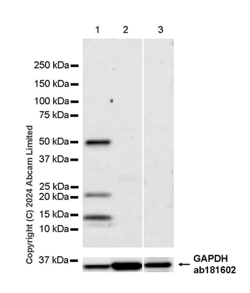 Western blot - Anti-Inhibin beta E chain antibody [EPR29191-125] - BSA and Azide free (AB324782)