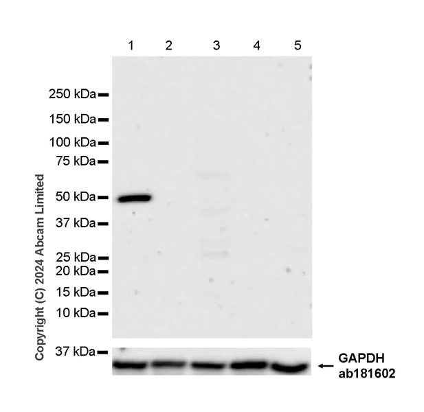 Western blot - Anti-Inhibin beta E chain antibody [EPR29191-125] - BSA and Azide free (AB324782)