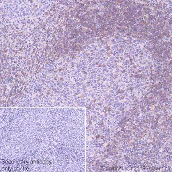 Immunohistochemistry (Formalin/PFA-fixed paraffin-embedded sections) - Inhibitory Immune Checkpoint panel 2 - Human IHC (AB278175)