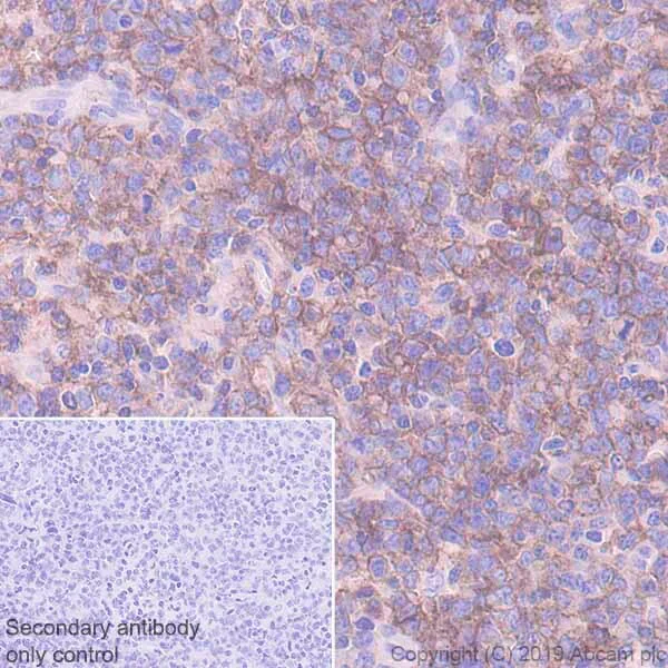 Immunohistochemistry (Formalin/PFA-fixed paraffin-embedded sections) - Inhibitory Immune Checkpoint panel 2 - Human IHC (AB278175)