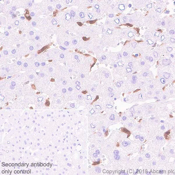 Immunohistochemistry (Formalin/PFA-fixed paraffin-embedded sections) - Inhibitory Immune Checkpoint panel 2 - Human IHC (AB278175)