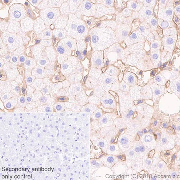 Immunohistochemistry (Formalin/PFA-fixed paraffin-embedded sections) - Inhibitory Immune Checkpoint panel 2 - Human IHC (AB278175)