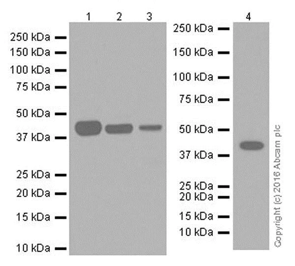 Western blot - Inhibitory Immune Checkpoint panel 2 - Human WB (AB278173)
