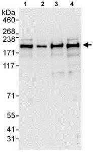 Western blot - Anti-INO80 antibody (AB118787), expandable thumbnail