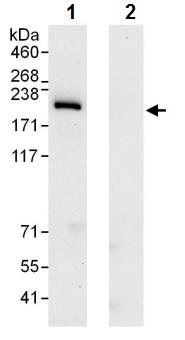 Immunoprecipitation - Anti-INO80 antibody (AB245619)