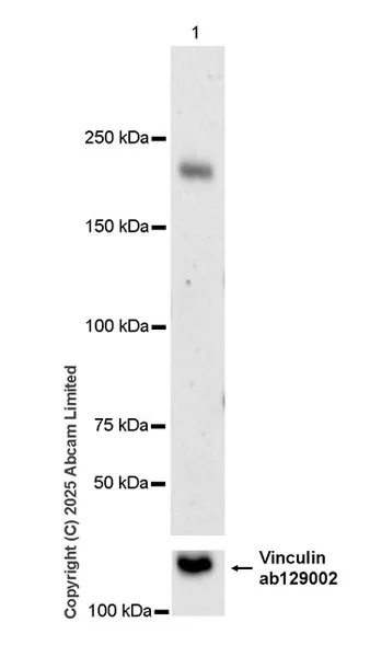 Western blot - Anti-INO80 antibody [EPR30384-761] (AB325542)