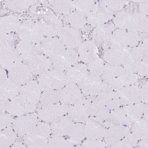 Immunohistochemistry (Formalin/PFA-fixed paraffin-embedded sections) - Anti-INO80C antibody (AB151046)