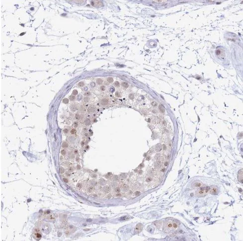 Immunohistochemistry (Formalin/PFA-fixed paraffin-embedded sections) - Anti-INO80C antibody (AB151046)