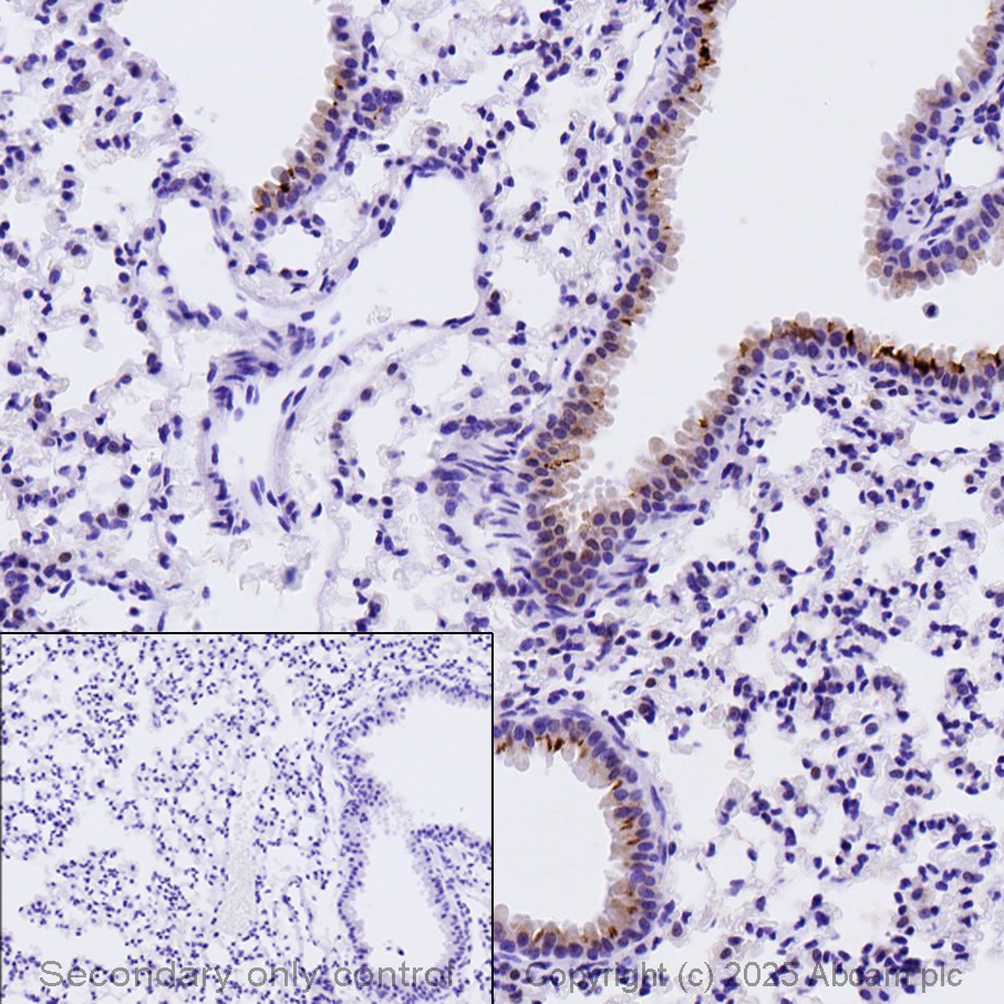 Immunohistochemistry (Formalin/PFA-fixed paraffin-embedded sections) - Anti-iNOS antibody (ab15323), expandable thumbnail