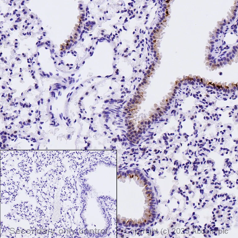 Immunohistochemistry (Formalin/PFA-fixed paraffin-embedded sections) - Anti-iNOS antibody (AB15323)