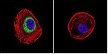 Immunocytochemistry/ Immunofluorescence - Anti-iNOS antibody (AB3523)