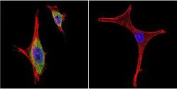 Immunocytochemistry/ Immunofluorescence - Anti-iNOS antibody (AB3523)