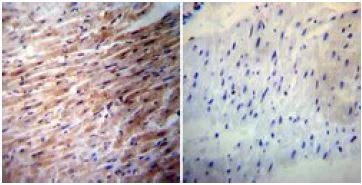 Immunohistochemistry (Formalin/PFA-fixed paraffin-embedded sections) - Anti-iNOS antibody (AB3523)